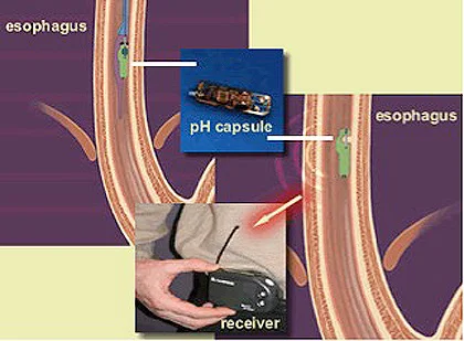 eCAP — project image 6